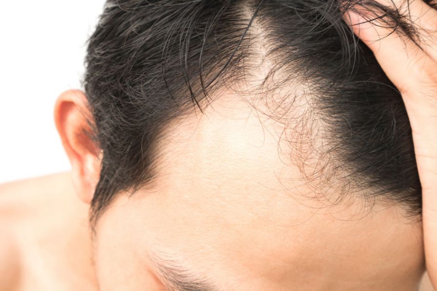 New hope for the bald! Times Knowledge India
