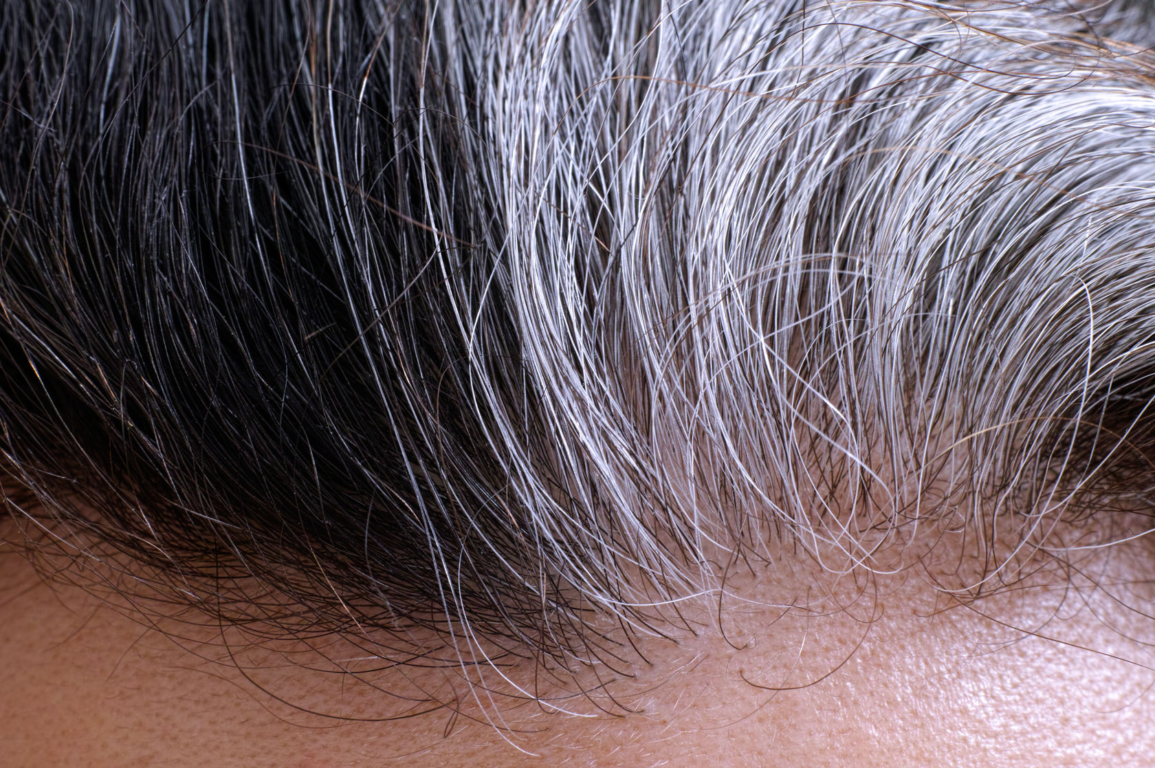 Can Fright Really Turn Your Hair White? | Times Knowledge ...